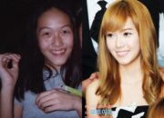10 Artis Korea yang Cantik Berkat Operasi Plastik Transformasi yang Mengubah Karir!