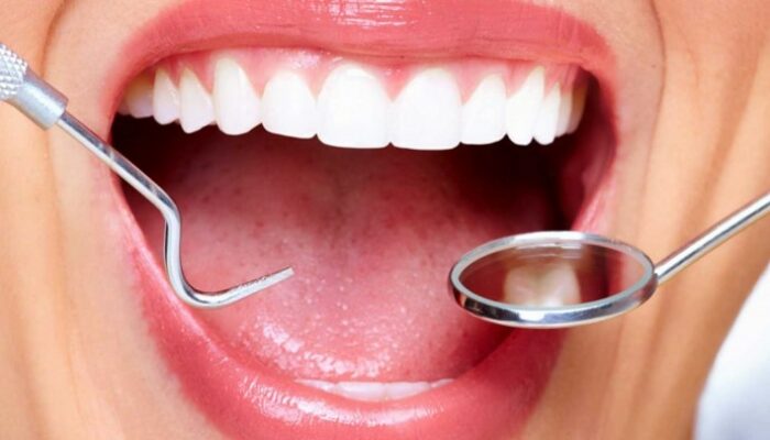 Cabut Gigi Geraham Berlubang: Prosedur Biaya dan Tips Perawatan!